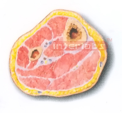 HUMAN TRANSVERSE SECTION MODEL THROUGH THE PROXIMAL 1/3 OF THE RIGHT LEG (A)